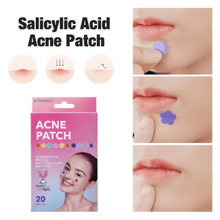 Acne Patches